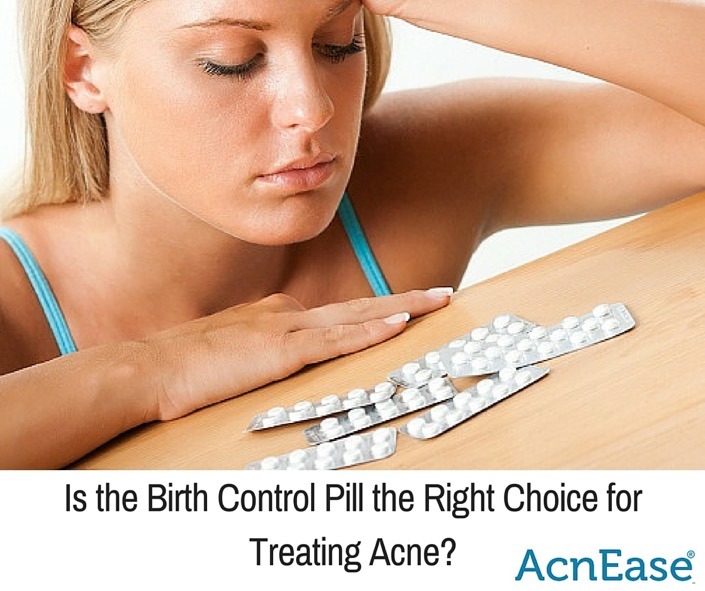 Is Birth Control Pill The Right Choice For Treating Acne